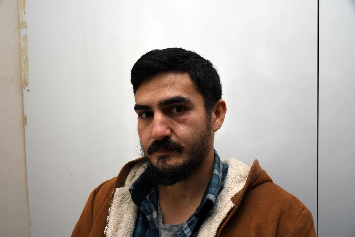 Kavga sırasında oğlunu bastonunu savurarak kurtarmaya çalıştı