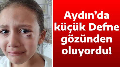 Aydın&rsquo;da k&uuml;&ccedil;&uuml;k Defne g&ouml;z&uuml;nden oluyordu!
