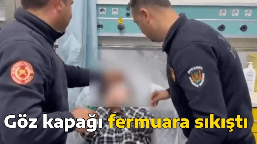 G&ouml;z kapağı fermuara sıkıştı